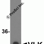Western blot analysis of VLK expression in Jurkat cell lysate with VLK antibody at 0.5 μg/ml.