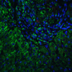 Immunofluorescence of VPS39 in human liver tissue with VPS39 antibody at 5 μg/ml. <br><br>Green: VPS39 antibody (6183) <br> Red: Phylloidin staining<br> Blue: DAPI staining