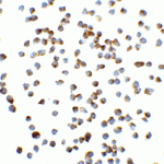 <strong>Figure 6 Immunocytochemistry Validation of Vinculin in Jurkat Cells</strong><br>Immunocytochemical analysis of Jurkat cells using anti-Vinculin antibody (7807) at 5 μg/ml. Cells was fixed with formaldehyde and blocked with 10% serum for 1 h at RT; antigen retrieval was by heat mediation with a citrate buffer (pH6). Samples were incubated with primary antibody overnight at 4°C. A goat anti-rabbit IgG H&L (HRP) at 1/250 was used as secondary. Counter stained with Hematoxylin.