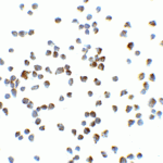 <strong>Figure 4 Immunocytochemistry Validation of Vinculin in Jurkat Cells</strong><br>Immunocytochemical analysis of Jurkat cells using anti-Vinculin antibody (7809) at 5 μg/ml. Cells was fixed with formaldehyde and blocked with 10% serum for 1 h at RT; antigen retrieval was by heat mediation with a citrate buffer (pH6). Samples were incubated with primary antibody overnight at 4°C. A goat anti-rabbit IgG H&L (HRP) at 1/250 was used as secondary. Counter stained with Hematoxylin.