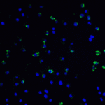 <strong>Figure 5 Immunofluorescence Validation of Vinculin in Jurkat Cells</strong><br>Immunofluorescent analysis of 4% paraformaldehyde-fixed Jurkat cells labeling Vinculin with 7809 at 20 μg/mL, followed by goat anti-rabbit IgG secondary antibody at 1/500 dilution (green) and DAPI staining (blue).