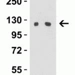 <strong>Figure 3 Western Blot Validation in PC3 Cell Lysate</strong><br>Loading: 15 μg of lysates per lane.Antibodies: Vinculin 7807 (Lane 1: 0.5 μg/mL and Lane 2: 1 μg/mL),  1h incubation at RT  in 5% NFDM/TBST.Secondary: Goat anti-rabbit IgG HRP conjugate at 1:10000 dilution.