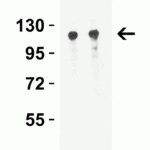 <strong>Figure 3 Western Blot Validation in PC3 Cell Lysate</strong><br>Loading: 15 μg of lysates per lane.Antibodies: Vinculin 7809 (Lane 1: 0.5 μg/mL and Lane 2: 1 μg/mL),  1h incubation at RT  in 5% NFDM/TBST.Secondary: Goat anti-rabbit IgG HRP conjugate at 1:10000 dilution.