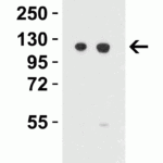 <strong>Figure 4 Western Blot Validation in Mouse 3T3/balb Cell Lysate</strong><br>Loading: 15 μg of lysates per lane.Antibodies: Vinculin 7489 (Lane 1: 0.5 μg/mL and Lane 2: 1 μg/mL), 1h incubation at RT in 5% NFDM/TBST.Secondary: Goat anti-rabbit IgG HRP conjugate at 1:10000 dilution.
