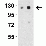 <strong>Figure 4 Western Blot Validation in Human Liver Tissue Lysate</strong><br>Loading: 15 μg of lysates per lane.Antibodies: Vinculin 7807 (Lane 1: 0.5 μg/mL and Lane 2: 1 μg/mL),  1h incubation at RT  in 5% NFDM/TBST.Secondary: Goat anti-rabbit IgG HRP conjugate at 1:10000 dilution.