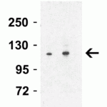 <strong>Figure 5 Western Blot Validation in Rat Liver Tissue Lysate</strong><br>Loading: 15 μg of lysates per lane.Antibodies: Vinculin 7807 (Lane 1: 0.5 μg/mL and Lane 2: 1 μg/mL),  1h incubation at RT  in 5% NFDM/TBST.Secondary: Goat anti-rabbit IgG HRP conjugate at 1:10000 dilution.
