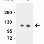 <strong>Figure 1 Western Blot Validation in Human PC-3 Cell Lysate</strong><br>Loading: 15 μg of lysates per lane.Antibodies: Vinculin 7489 (Lane 1: 0.5 μg/mL and Lane 2: 1 μg/mL), 1h incubation at RT in 5% NFDM/TBST.Secondary: Goat anti-rabbit IgG HRP conjugate at 1:10000 dilution.