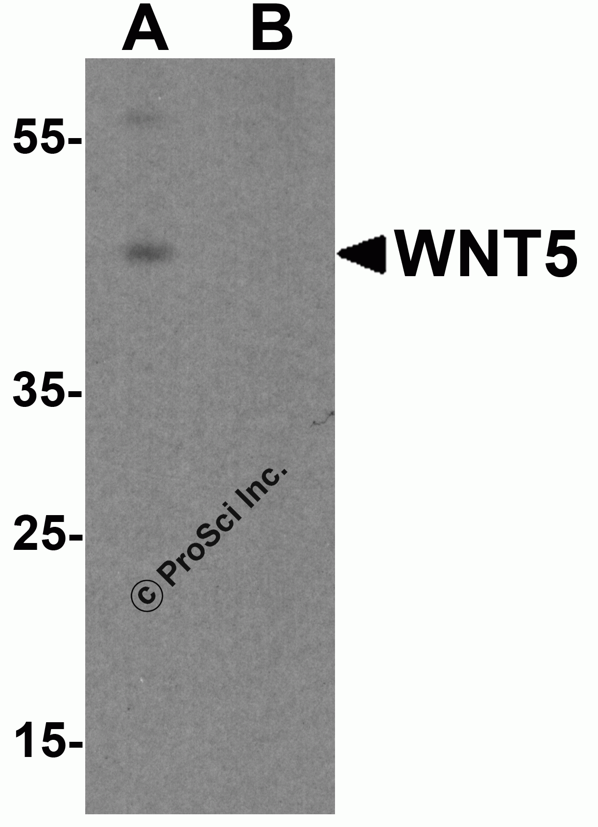 WNT5 Peptide