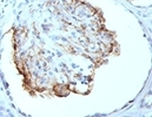 WT1 Antibody [WT1/857]
