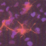Anti-GFAP Immunostaining of astrocytes in rat neural progenitor cell culture. XG-6155 with anti-rabbit IgG Cy3 (red) and DAPI (blue) were used.