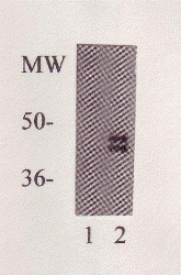 PPARgamma Antibody