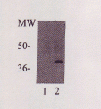 C-Reactive Protein Antibody