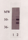 C-Reactive Protein Antibody