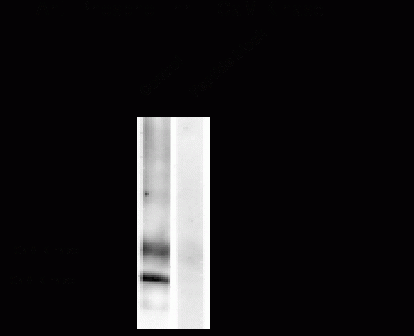 CaM Kinase II (phospho Thr286) Antibody