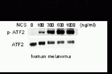 ATF2 (phospho Ser 490 / 498)  Antibody