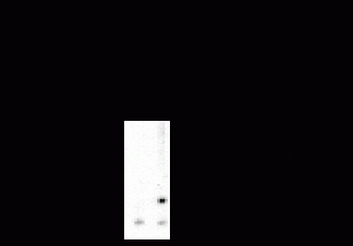 DARPP 32 (phospho Thr34)  Antibody