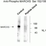 Western blot of rat brain lysate showing phospho-specific immunolabeling of the ~87k MARCKS protein.