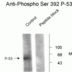 Western blot of rat brain fraction lysate showing phosphospecific immunolabeling of the ~53k p53 protein phosphorylated at Ser392.