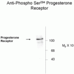Western blot of whole T47D lysate prepared from cells that had been incubated in the presence of synthetic progestin agonist R5020 (500nm) showing phosphospecific immunolabeling of the ~90k PR-A isoform and the ~120k PR-B isoform of the progesterone receptor phosphorylated at Ser294.