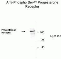 Progesterone Receptor (phospho Ser294) Antibody [608]