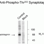 Synaptotagmin (Phospho-Thr202) Antibody
