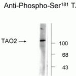 TAO2 (Phospho-Ser181) Antibody