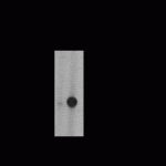 Tyrosine Hydroxylase (Phospho-Ser31) Antibody