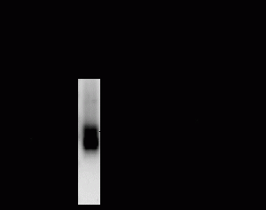 GABA A Receptor beta 2 Antibody