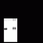 GABA A Receptor beta 3, CT Antibody