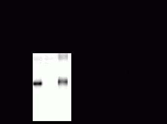 GABA A Receptor beta 3 Antibody