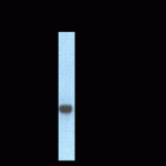 Glycine Receptor Antibody