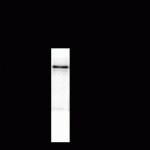 NMDA NR1 Subunit Antibody
