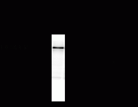 NMDA NR1 Antibody [R1JHL]