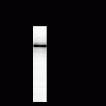 NMDA NR2B Subunit Antibody
