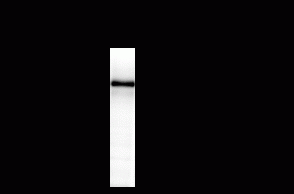 NMDA NR2B Antibody