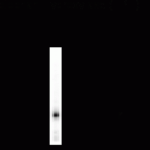 Tryptophan Hydroxylase Antibody
