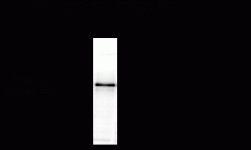 Tyrosine Hydroxylase Antibody