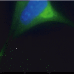 Immunocytochemistry staining of endogenous AP3B2 in AtT-20 cells. XW-7031 dilution: 1:200; Donkey anti-IgY Fc-FITC: 1:200.
