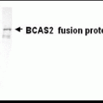 Western Blot: E coli-derived fusion protein as test antigen. XW-7054 dilution: 1:2,000.
