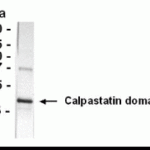 Western Blot detection of CAST antibody.