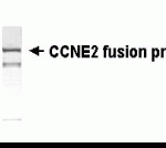 E coli-derived fusion protein as test antigen. XW-7077 dilution: 1:2,000.