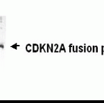 Western Blot detection of CDKN2A antibody.