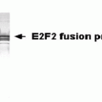 Western Blot: XW-7165 dilution: 1:2,000. E-coli derived fusion protein as test antigen.