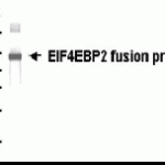Western Blot: E coli-derived fusion protein as test antigen. XW-7175 dilution: 1:2,000.