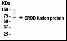 EGFR Antibody
