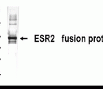 Western Blot: XW-7188 at a 1:2,000 dilution, staining E coli-derived fusion protein as test antigen by Western blot.