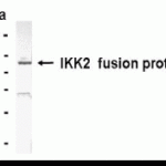 Western blot of IKK beta antibody (XW-7282). Predicted band size : 84 kDa. E. coli derived fusion protein as test antigen. XW-7282 dilution: 1:2000.