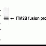Western blot detection of ITM2B (N-60) antibody.