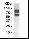 LDLR Antibody