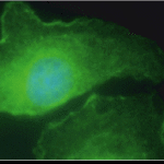 Immunocytochemical staining using M6PR antibody.